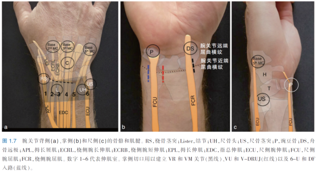 沿着指屈总腱的尺侧缘在腕关节近端褶皱的中心做一个2cm的纵向皮肤