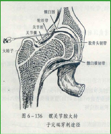 骨科精读|20种关节腔穿刺技术,你想知道的都在这了!