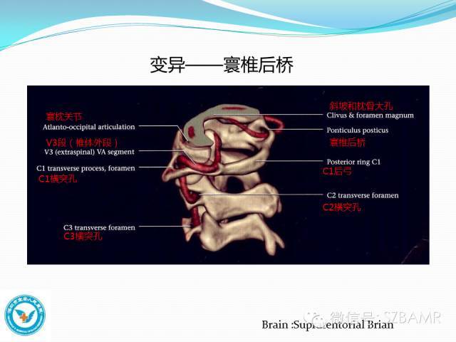 椎动脉左右各有一支,它穿行于颈椎两侧的横突孔,向上行进入头颅内,两