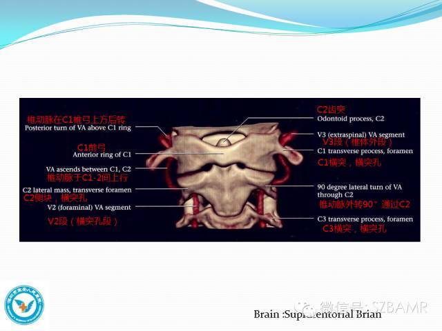 椎动脉左右各有一支,它穿行于颈椎两侧的横突孔,向上行进入头颅内,两