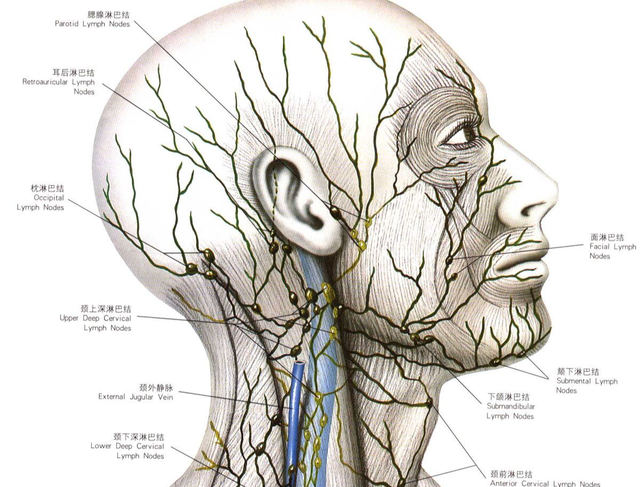 头颈肿瘤继发淋巴水肿并不是肿瘤转移有症状的患者要重视起来