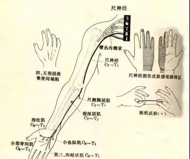 尺神经在前臂尺侧腕屈肌深面伴尺动脉下行,至桡腕关节上方发出尺神经