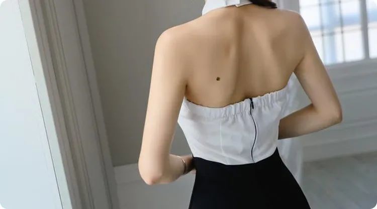 背部边缘有痣古书中有对这颗痣的赞美"父母安康有祖业,子女孝顺儿孙