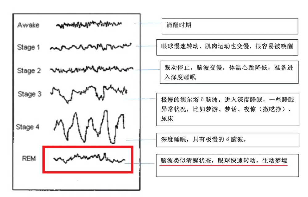 (睡眠各个阶段脑电波)