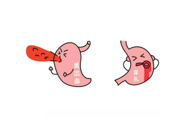 严重的胃溃疡会伴随着胃出血症状的出现,这不仅会出现便血的情况,甚至
