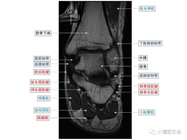 一文掌握|踝关节mr断层解剖