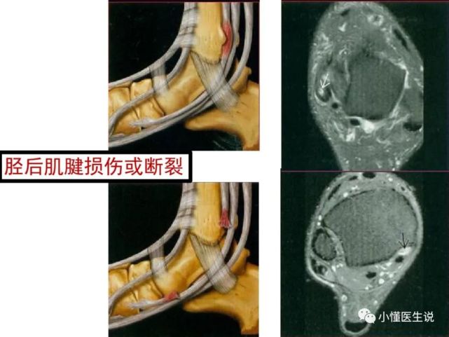 一文掌握|踝关节mr断层解剖