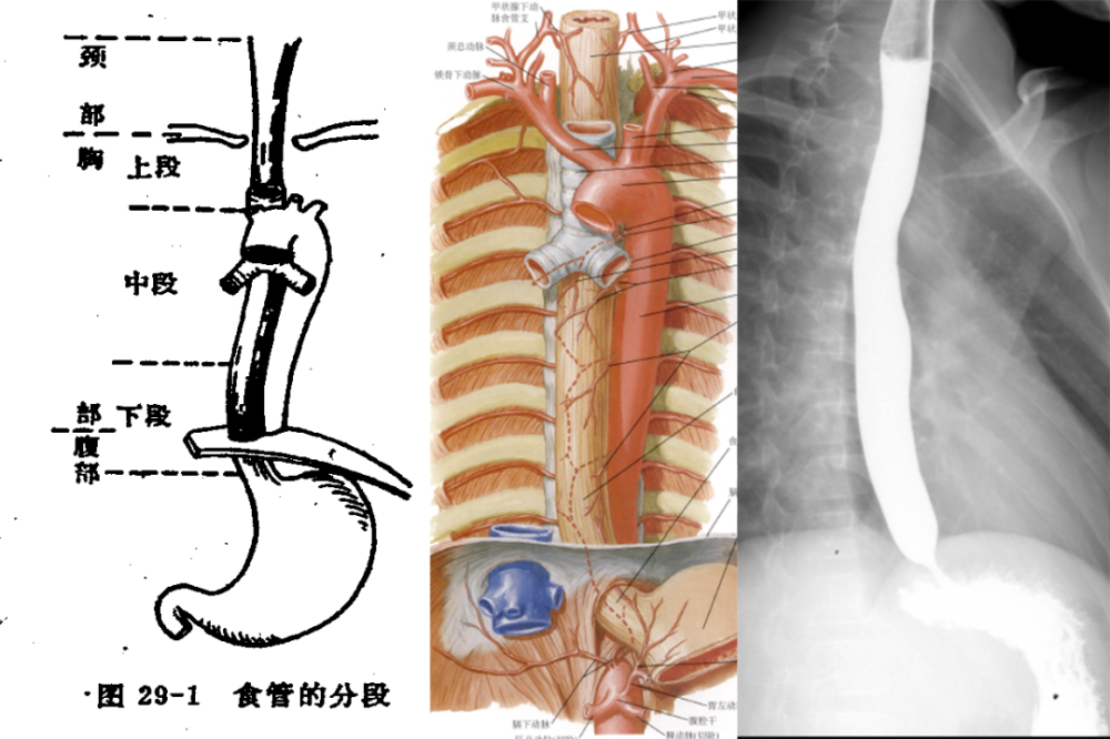 通过病例一起来学习食管影像解剖和非肿瘤性病变