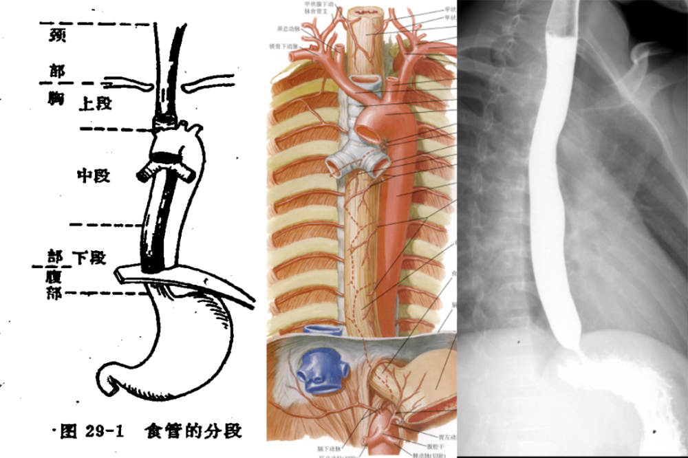 食管分为三段:颈段,胸段及腹段 颈段:咽移行处至胸廓开口平面 胸段
