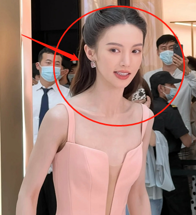 又一女明星瘦成"排骨胸",路人镜头下的金晨,我没眼花?