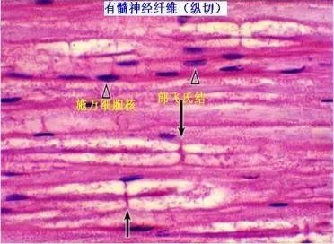 有髓神经纤维上神经冲动的传导从一个郎飞结跳到下一个郎飞结,呈跳跃