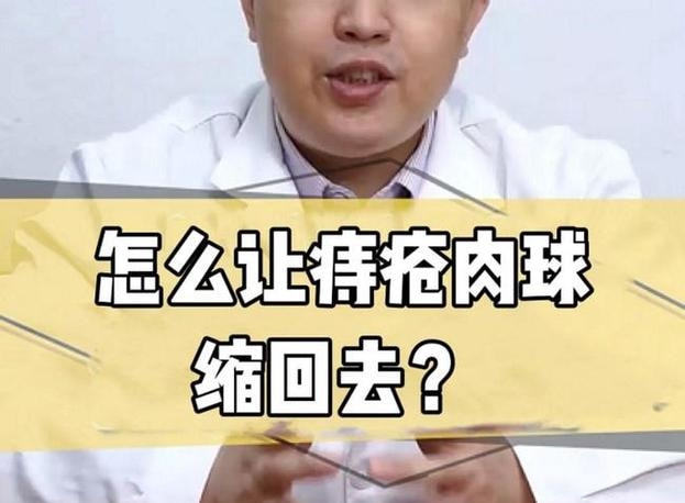 痔疮肉球可以消除吗?这几个小妙招能快速消球不复发!