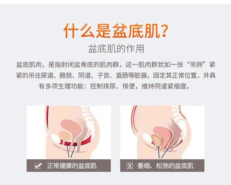 关于盆底肌的7个小知识