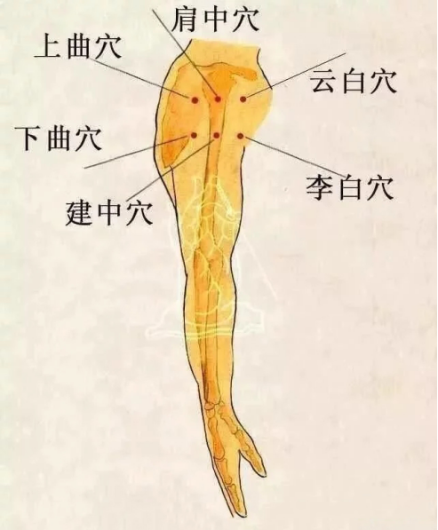 【坐骨神经痛】特效针灸方法——快速搞定坐骨神经痛