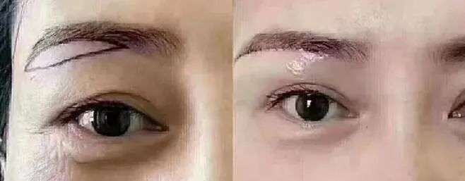 提眉后看着太凶不自然可能是这些原因造成的