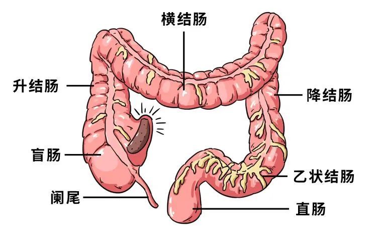 从广义上来说:发生在肛门,大肠的各种疾病都叫做肛肠疾病,常见病大概