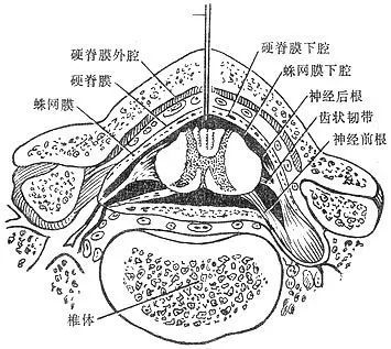 颈椎间盘突出压迫硬膜囊,严重吗?是压迫脊髓了吗?