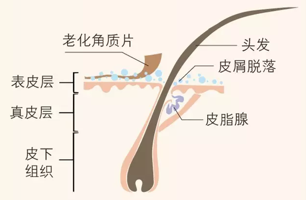 头屑 = 过度繁殖的马拉色菌   异常分泌的油脂病理性脱屑可能是感染