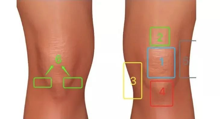 郴州骨科医院为您推荐一张图告诉你膝盖疼痛位置与对应病症!