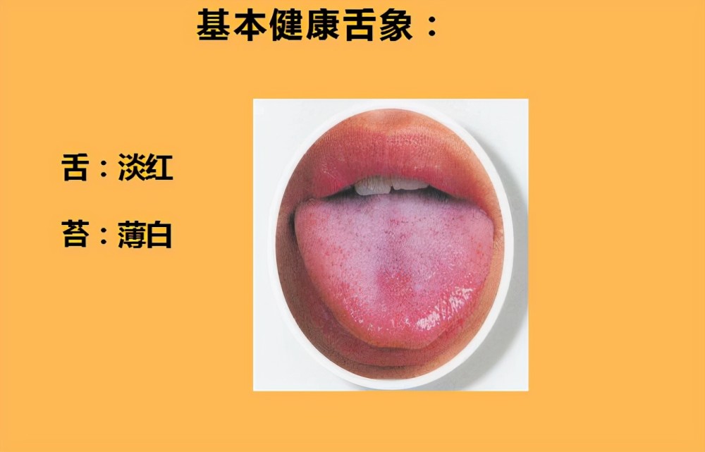 首先要给大家讲一下正常舌象,正常的舌象舌体柔软,活动自如,颜色淡红