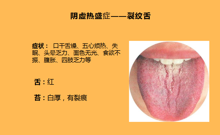 舌象反映不同的问题分析五种不同体质症状的舌象