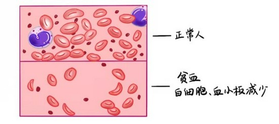 打升白针后出现幼稚细胞_化疗后白细胞低吃什么_化疗耐药后还能化疗吗