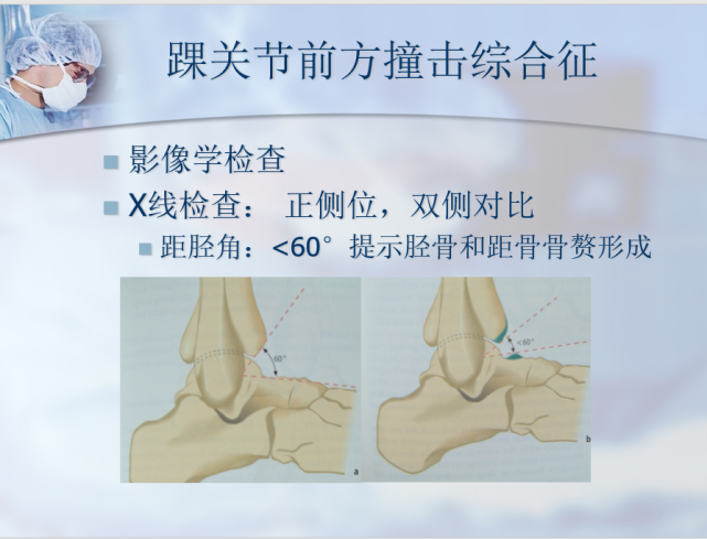 反复强迫背伸,跖屈创伤或疲劳损伤    2.踝前肿痛   3.背伸受限    4.