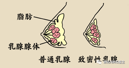 脂肪,一般是没有癌变隐患的安全组织,所以胸大的女性患乳腺癌的几率并