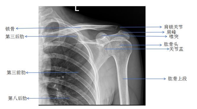先复习下肩关节正常解剖