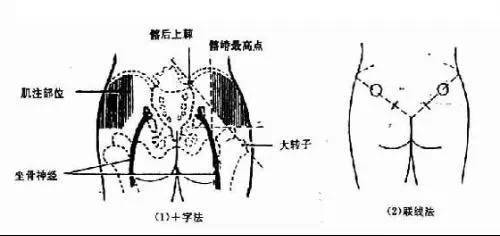 护士须知各种常用注射法详解