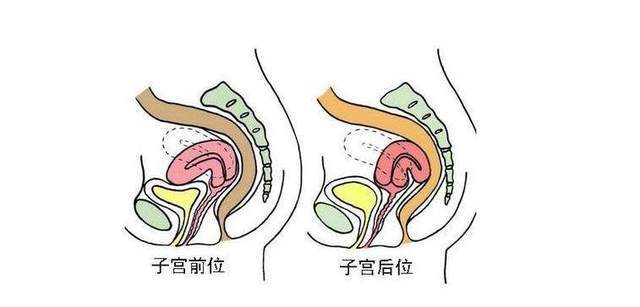 二,子宫后置能怀孕吗所谓子宫后置,其实就是后位子宫,因为在通常情况