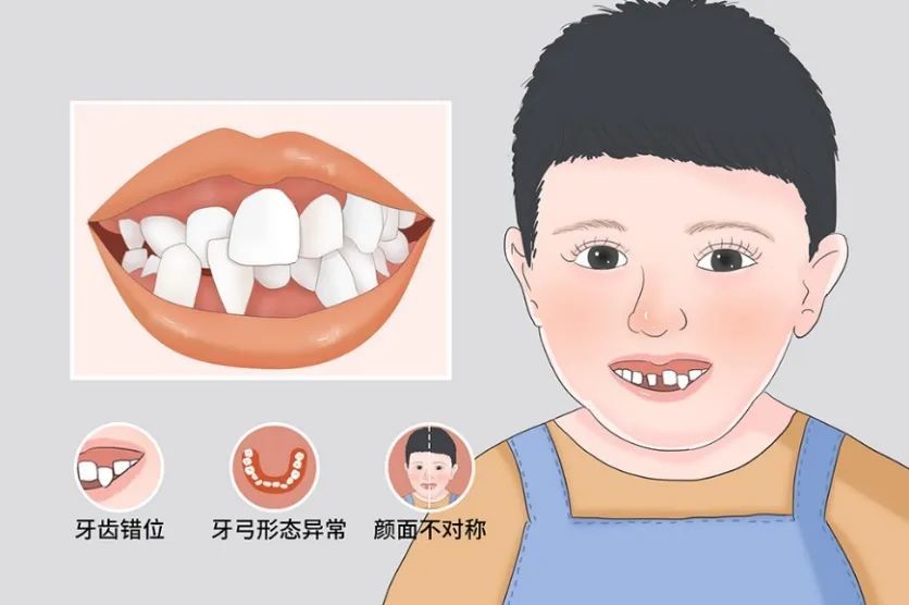 【转需】上海最新牙列不齐筛查启动,报名免费!