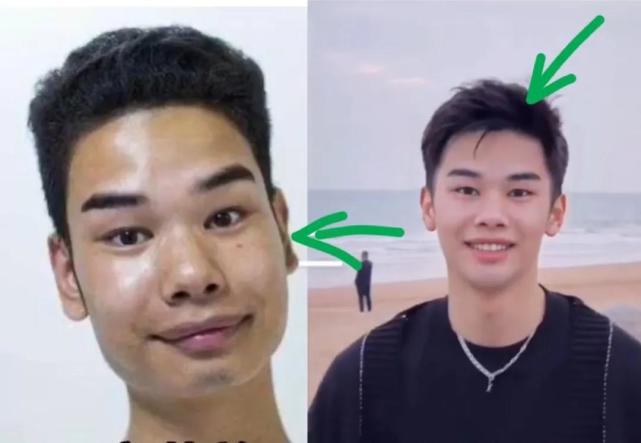 发际线网红小吴变成帅哥,还得到