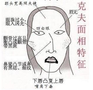 古人四不娶:仰脸女子外八脚,人中有痣颧骨高,是什么