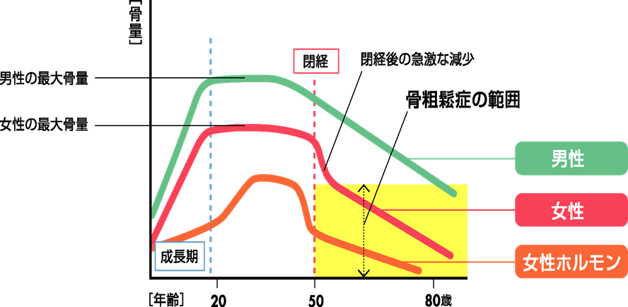 【汤汤播报】王万民:认识骨质疏松症