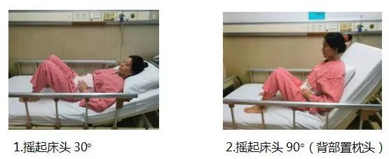 剖宫产术后下床活动操作指南:分6步讲清护理要点!