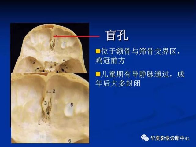 实用,详细的颅底各孔道影像解剖!