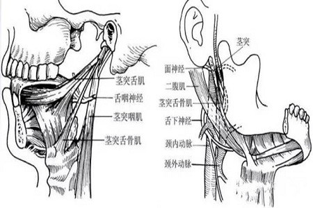 由于茎突过长或茎突的方位,形态异常,刺激茎突邻近部位的神经,血管