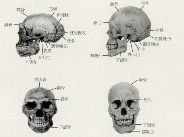 眼眶呈长方形,外侧下缘圆钝;上颌骨颧突下缘弯曲;额骨与鼻骨和额骨与