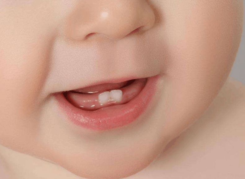 育儿小诀窍乳牙萌出后需细心照料