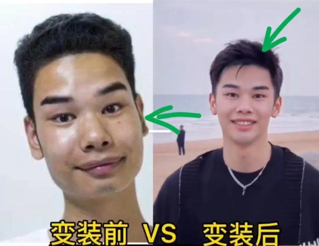 发际线网红小吴变成帅哥,还得到富婆青睐