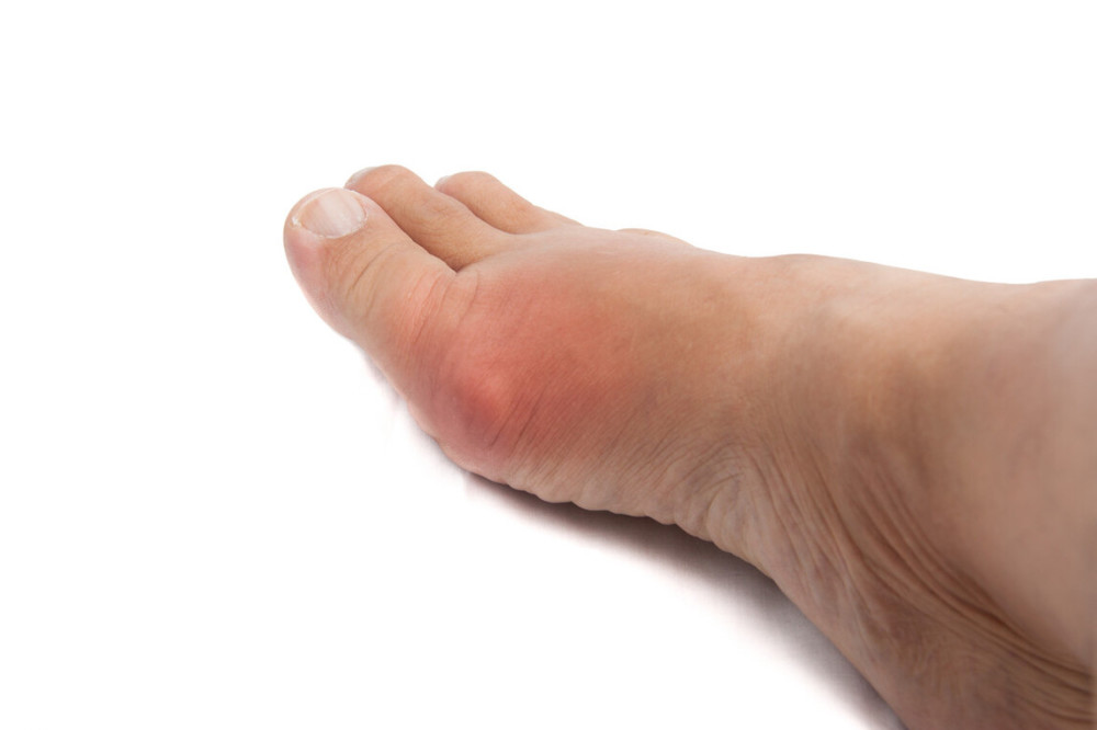 身体有疾,脚先知道 脚部的10种异常或与疾病相关,早知道早干预