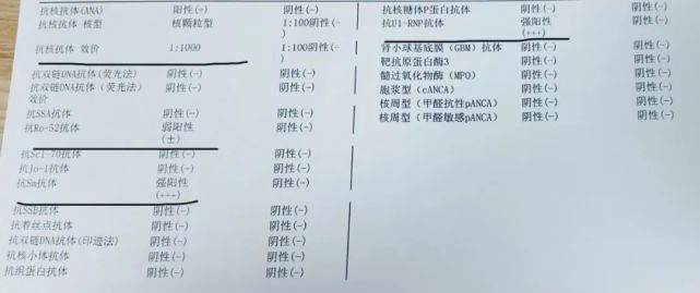 一文教你看懂抗核抗体谱