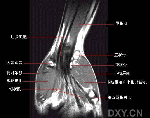 七个层面腕关节冠状位 正常mri解剖手背面的肌肉,血管和神经手掌面的