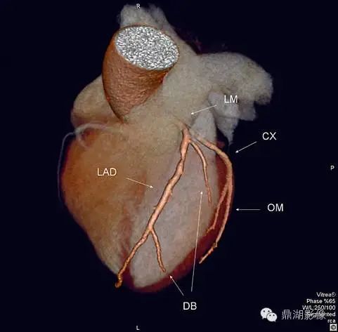 影像解剖▕心脏|心脏|冠脉|动脉