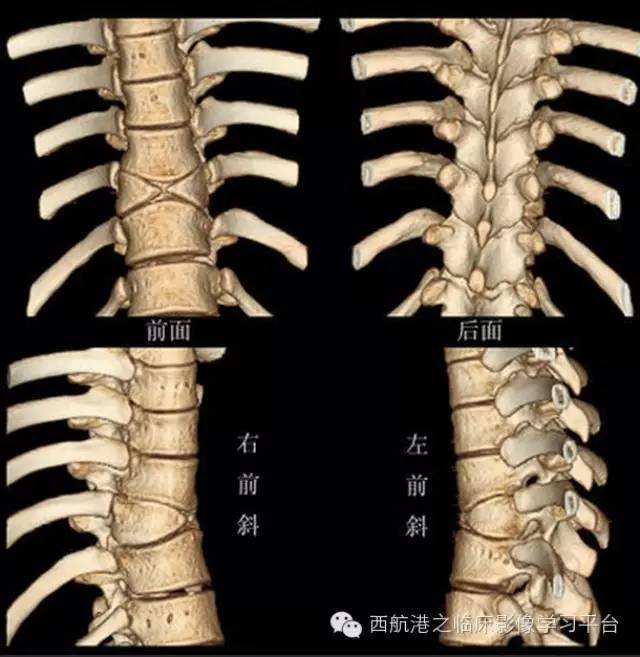 7,半椎体