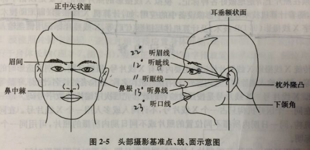 体位及扫描范围体位:仰卧位,头置于头架中,下颌内收,使头颅正中矢状