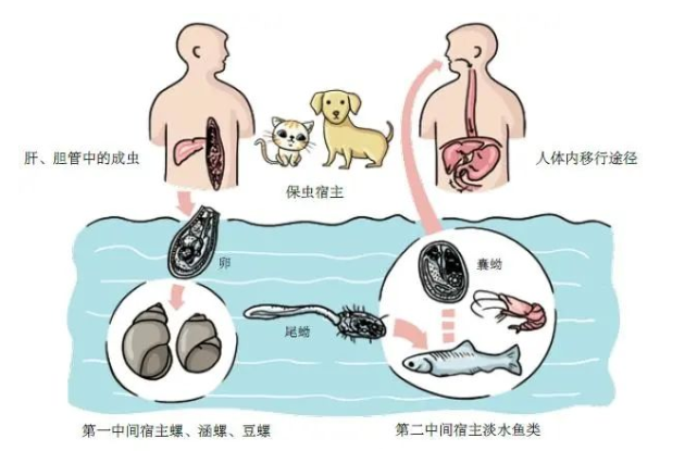 什么是肝吸虫病?这种病真的是"吃"出来的?