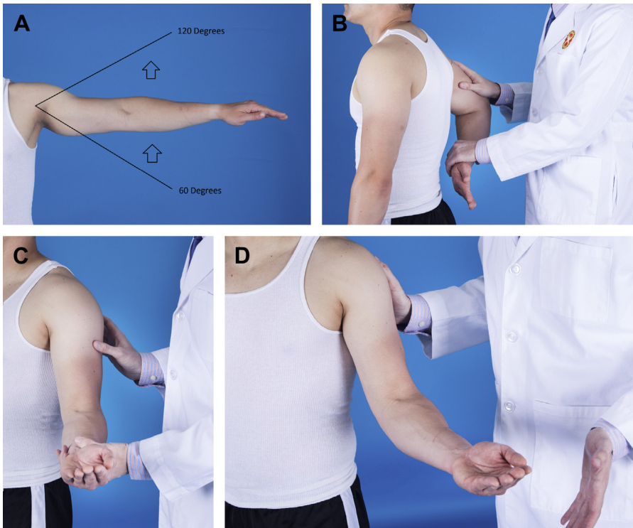 疼痛弧度测试是通过被动和主动地将患者的手臂从0度外展到180度来进行