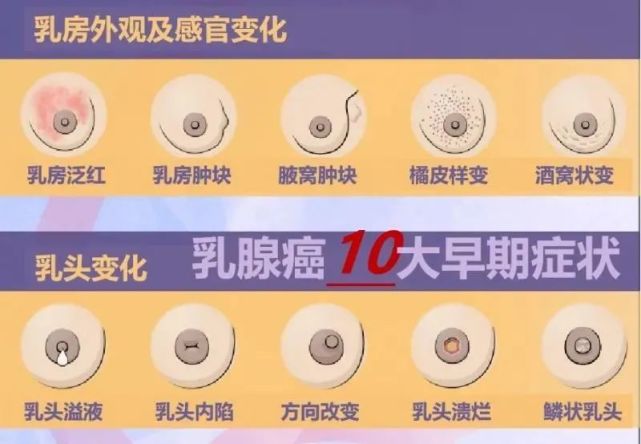 【女性健康】诊断乳腺癌需要做哪些检查项目?